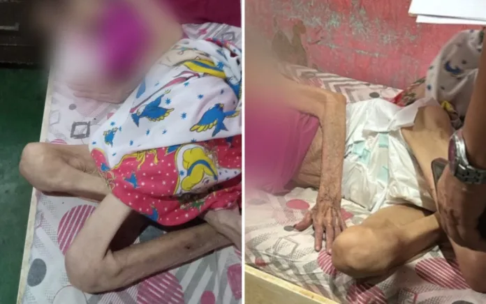 Morre idosa resgatada após ficar dias sem comer; filhos e ex-marido são investigados