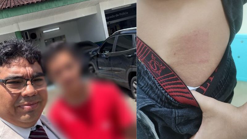 “Me chamou de bandido da boca”, diz adolescente autista agredido por motorista em Manaus