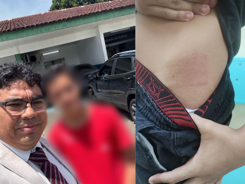 “Me chamou de bandido da boca”, diz adolescente autista agredido por motorista em Manaus